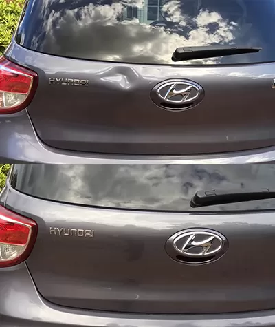 Park Hasarı Göçük Düzeltme